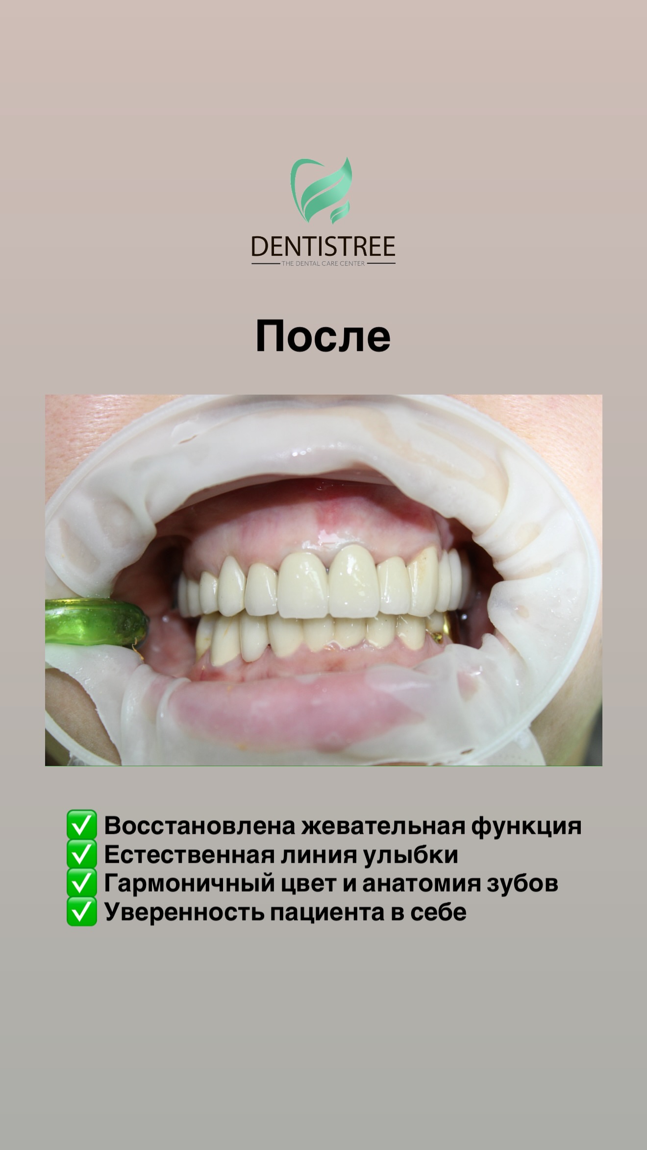Реставрация