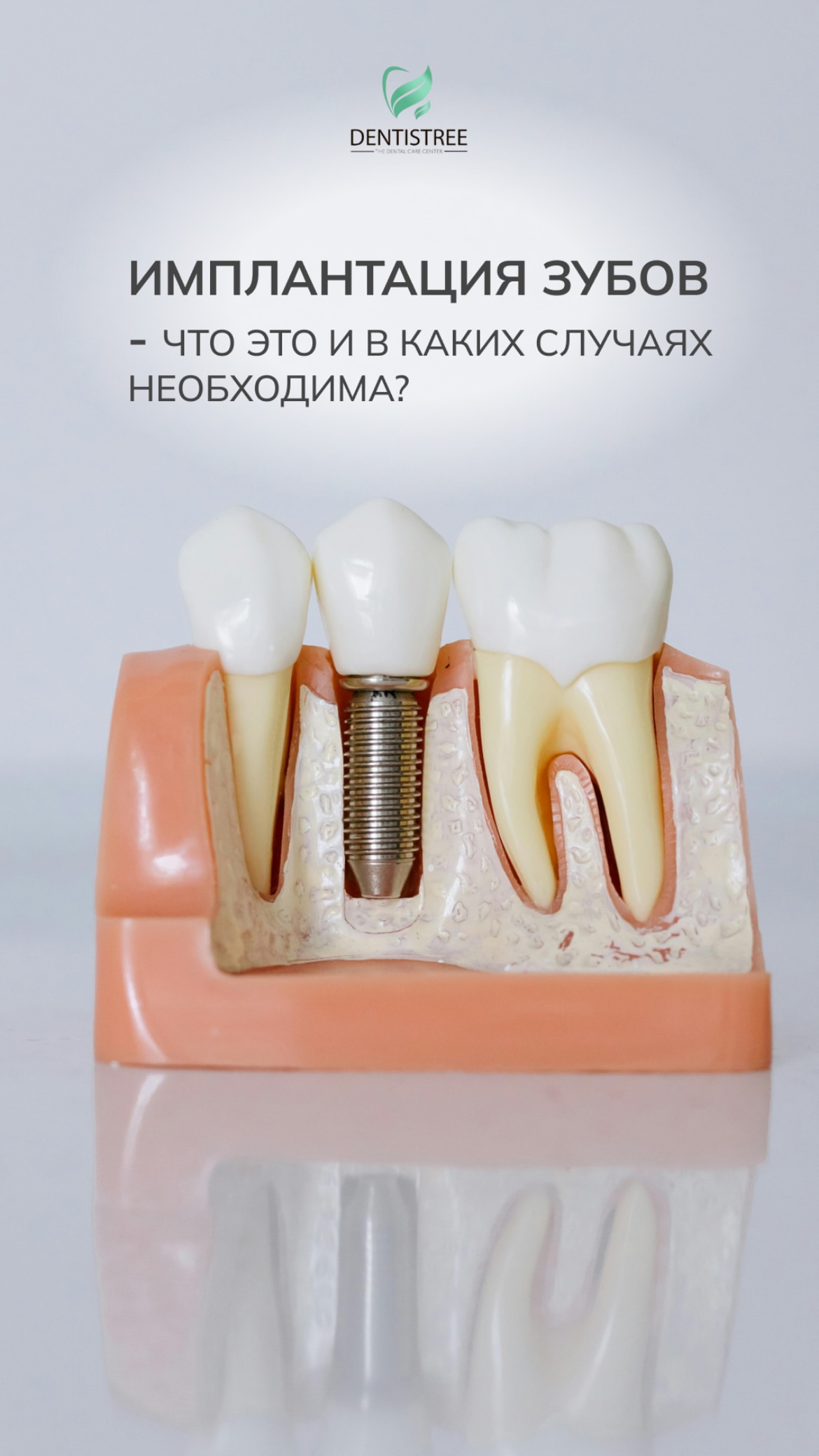 Работа — имплантация