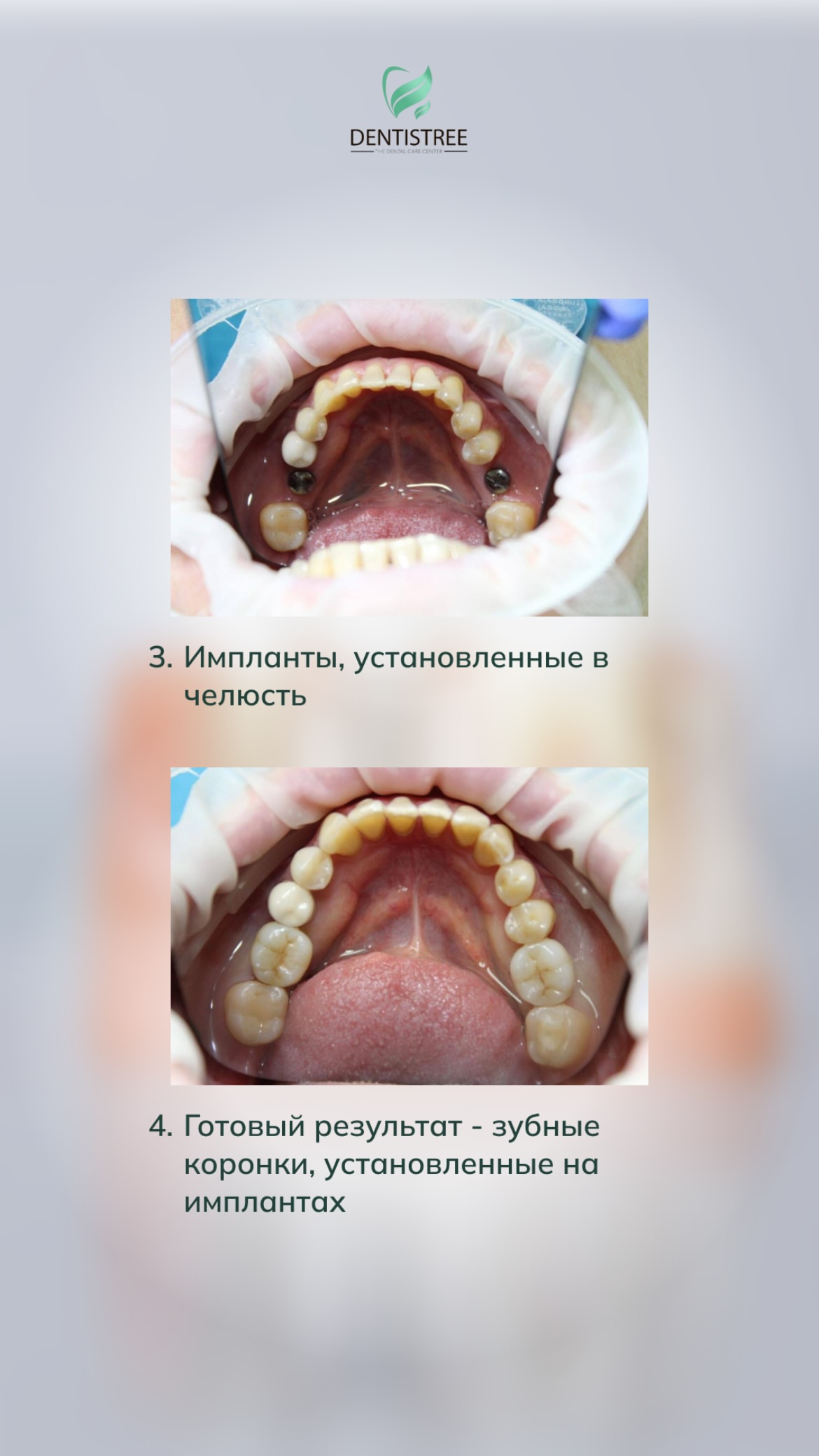 Комплексная реабилитация